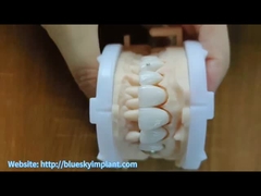 Mücevherli zirkonya tacı