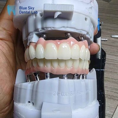 satın al Katmanlı Zirkonya implant özelleştirme Tam kemerli implant keseleri online manufacture