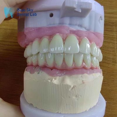 satın al Temiz Titanyum Çerçeveyle Evrensel Uyumluluk Metal Malo Köprüsü online manufacture