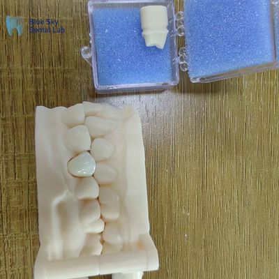 satın al Estetik Zirkonya Diş Restorasyonları Zirkonya Porselen Taçları online manufacture