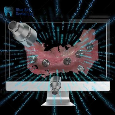 satın al Tek kullanımlı implant doğrudan tarama vücudu tümü bir diş tarama vücudu online manufacture