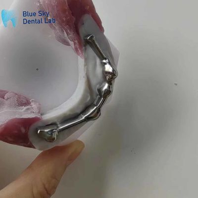 satın al Dental protez için abutment dişleri ile özelleştirilebilir diş titanyum çubuğu online manufacture
