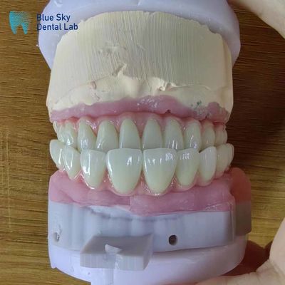 satın al Yapay tam kemerli diş implantları Cerrahi prosedürler için ameliyat vakaları online manufacture
