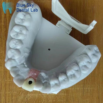 satın al Buhar Sterilizasyonu Tek İmplant Tacı Yumuşak Yüzey Diş İmplant Tacı online manufacture