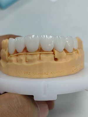 satın al 5mm-6mm Katmanlı Zirkonya Taçları Güç Zirkonya Çok Katmanlı Taç online manufacture