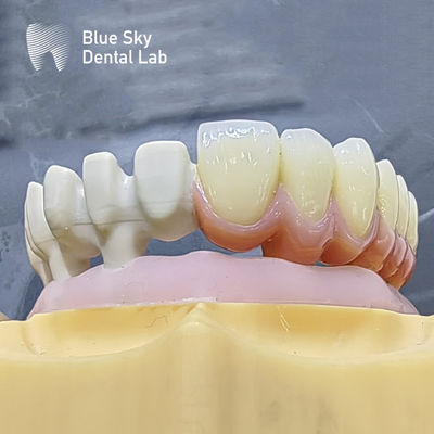 satın al Evrensel uyumluluk için pürüzsüz yüzey doğası tasarımı ile özel renkli implant vakaları online manufacture