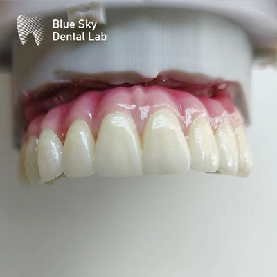 satın al Düzenli İmplantlı Aygıt Kuşları Buhar Sterilizasyonu İmplant Kuşları online manufacture