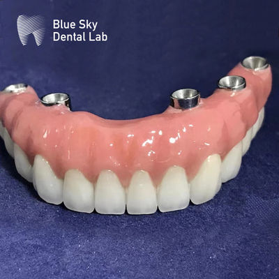 satın al Evrensel Otoklavlanabilir Dikdörtgen İmplant Kavşaları Yumuşak Yüzey Gümüş Renk online manufacture