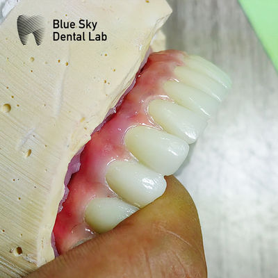 satın al Doğa Yüzey Evrensel Uyumlu Çoklu Seçenekler Buhar Sterilizasyonu için implant operasyon vakaları online manufacture
