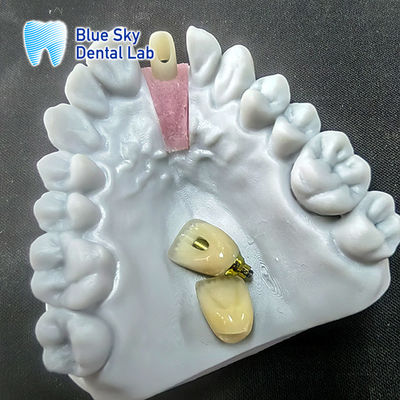 satın al Tek implant tacı ile hassasiyetle freze zirkonya abutment online manufacture