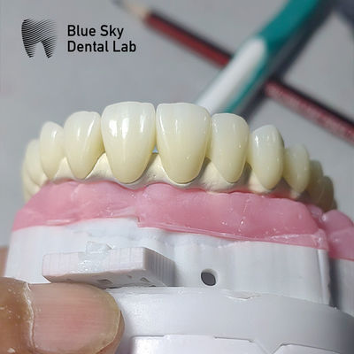 satın al Çoklu implant sistemleriyle uyumlu evrensel diş implantı kağıdı online manufacture