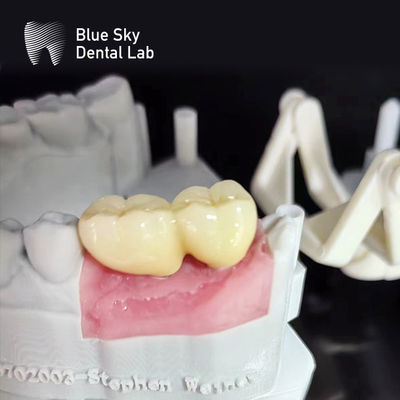 satın al Yumuşak yüzeyli implant keseleri Buhar sterilizasyonu Diş implant keseleri online manufacture