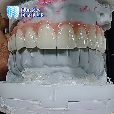 satın al Yapay Diş İmplantı Küresi Çoklu Sterilizasyon İmplant Küresi online manufacture