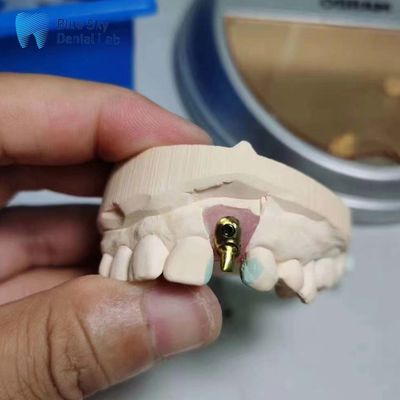 satın al Düzenli İmplant Kasaları Özel Tek İmplant Diş Offset Arch Implant Kasaları online manufacture