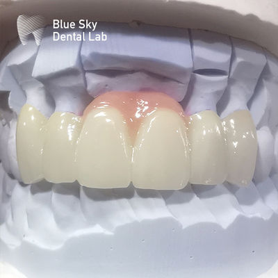satın al Eşitlik Restorasyonları İçin Dental Zirkonya Taçları online manufacture