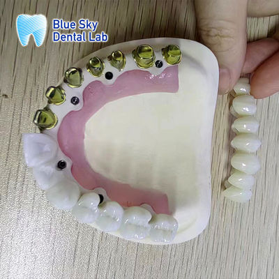 satın al Çoklu Düzenli İmplant Sistemi için Evrensel Tam Kemerli Diş İmplantı Küreleri online manufacture