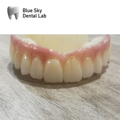 satın al Uyumluluk İmplant Kuşları Düzenli İmplant Sistemi Diş Kuşları online manufacture