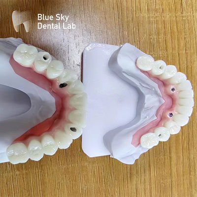 satın al Dental Multi implant vakaları Özel implant prosedürleri vakaları online manufacture