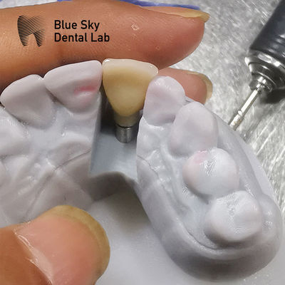 satın al Biyolojik uyumluluk çalışmaları implantasyon senaryoları buhar sterilizasyonu online manufacture
