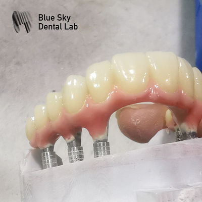 satın al Doğal Şekil Tam Kemerli Dental İmplant Küresi Yumuşak Yüzey Diş İmplant Küresi online manufacture