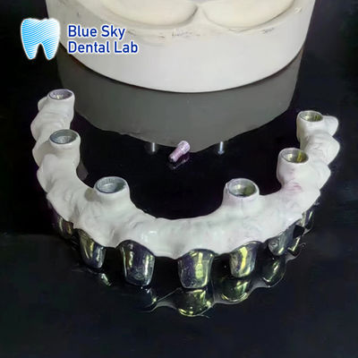 satın al Temiz Titanyum Malo Köprüsü Özelleştirilebilir Gümüş Metal Çerçeve Dişleri online manufacture