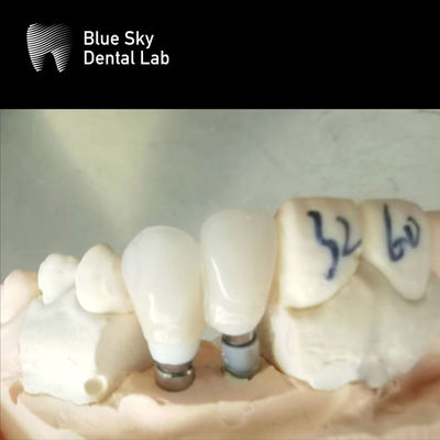 satın al Tek Taçlar Zirkonya Abutment Hipoallerjenik Diş İmplantı Zirkonya Abutment online manufacture