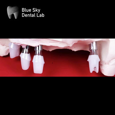 satın al Mavi Gökyüzü Diş İmplantları Zirkonya Abutment Kesinlikle Düzleştirilmiş online manufacture