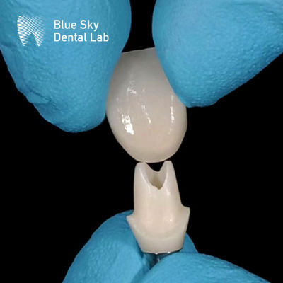 satın al Oral Scan Custom Zirkonya Abutment Yüksek Güçlü Zirkonya Abutments online manufacture