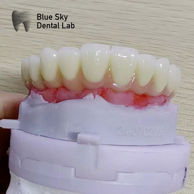 satın al Evrensel uyumluluğu ve en iyi performansı olan doğa implant prosedürü vakaları online manufacture