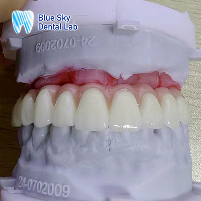 satın al Renkleri özelleştirmek Yüzey Ekleme Aracı Kasaları online manufacture