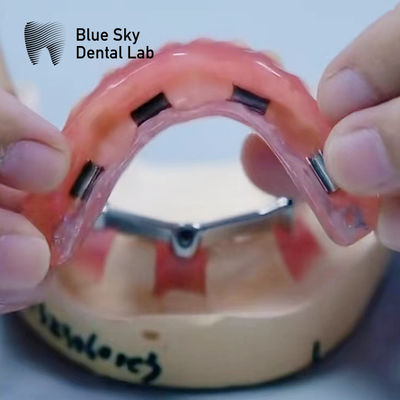 satın al Akrilik Diş Dişleri Dental Titanyum Çubukları Gümüş ve Altın online manufacture