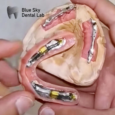 satın al Kaldırılabilir protez için titanyum çubuklu mavi gökyüzü diş implantları online manufacture