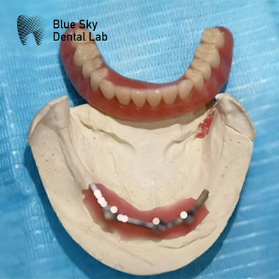 satın al Mavi Gökyüzü İmplantı Titanyum Çubuk Diş Dentistiği İmplant Dişleri için online manufacture