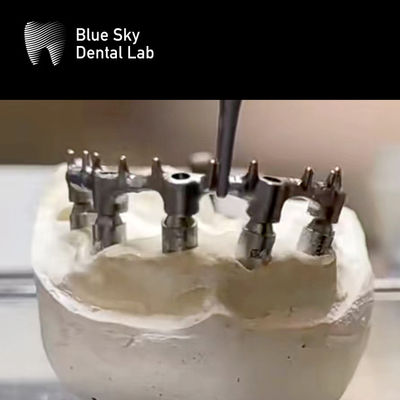 satın al Çıkarılabilir protez Ti Bar Dental Titanyum Bar Nail ile online manufacture