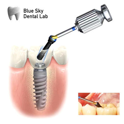 satın al İç Hex ASC Abutment Düzenlenebilir açılı vida kanalı abutment online manufacture