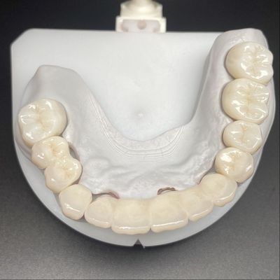 satın al Sabit Restorasyon İçin Katmanlı Zirkonya Köprüsü Güzel Gülümsemeler Profesyonel Sabit online manufacture