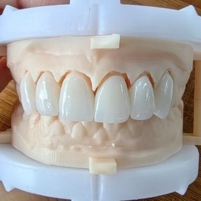 satın al Doğal Estetik Döşeli Zirkonya Taç Köprüsü Güzel Gülümseme ve İyi Restorasyon İçin FDA Ve CE Sertifikası online manufacture