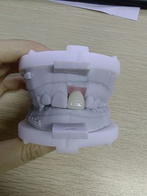 satın al Yüksek Dayanıklılıklı İmplant Kağıtları, çıkarılabilir protez esnekliği için 5'e kadar implant tutar online manufacture