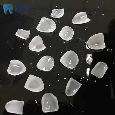 Ultra ince E Max kaplamalar Ingot sınıfı Keramik doğal görünümlü kaplamalar