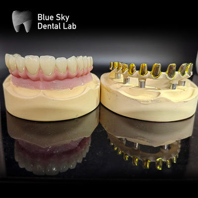 Vuruş tutulmuş MUA abutment implant vakaları zirkonya taçları kolay onarımlı çok katmanlı pembe porselen