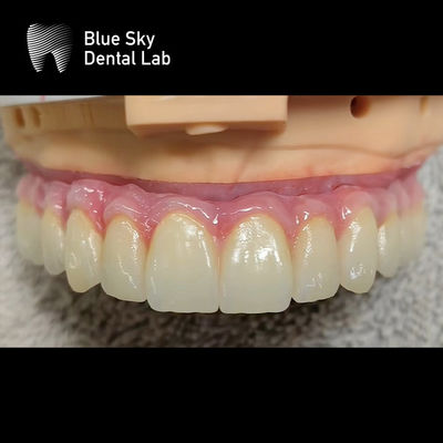Evrensel Çoklu Seçenekler Düz yüzey ve Steril Buhar Temizleme için tasarlanmış implant kafesleri