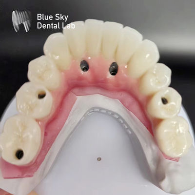 Çoklu implant sistemleri ile uyumlu tam kemerli diş implantları