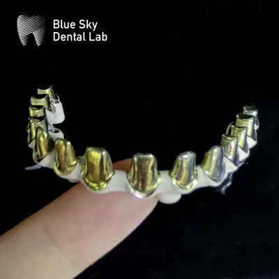 Gümüş Altın Evrensel Saf Titanyum Metal Çerçeve Dental Özel