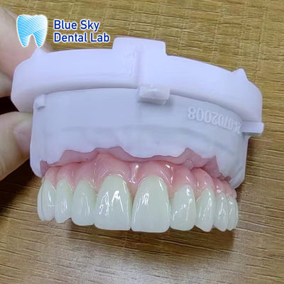 Optimal cerrahi sonuçlar için pürüzsüz yüzeyli implant kağıtları