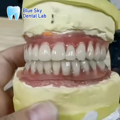 Tam Üst ve Alt Titanyum Çubuk Mavi Gökyüzü Diş İmplantları