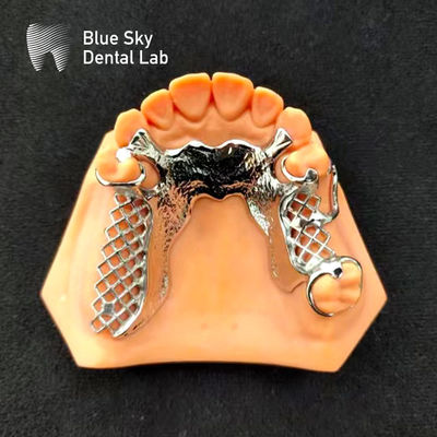 Skelet Chrome Metal Kısmi Diş Dişleri Baskılı CoCr Diş Dişleri Tasarımı