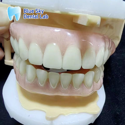 Bluesky Geçici Akrilik Kısmi Dente Tam Üst ve Alt Akrilik Dente
