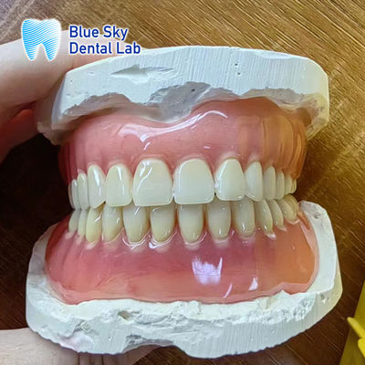 Eksik Dişler Akrilik Tam Diş Dentisi Restorasyon Akrilik Tam Diş Dentisi