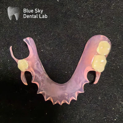 Kişiselleştirilmiş çıkarılabilir akrilik kısmi diş protezi doğal görünümlü Valplast diş kısımları