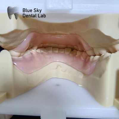 Balmumu Valplast Esnek Kısmi Diş Dişleri Valplast Kısmi Diş Dişleri Öncesinde ve Sonrasında